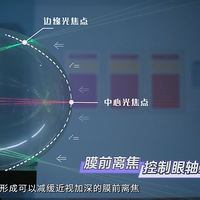 孩子近视了能恢复么？离焦眼镜怎么选？明月镜片轻松控怎么样？