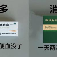 得了痔疮怎么办？痔疮膏怎么选花的不多？痔疮一定要知道！