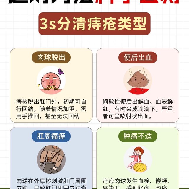 超全痔疮上岸攻略总结！痔缩力满满！